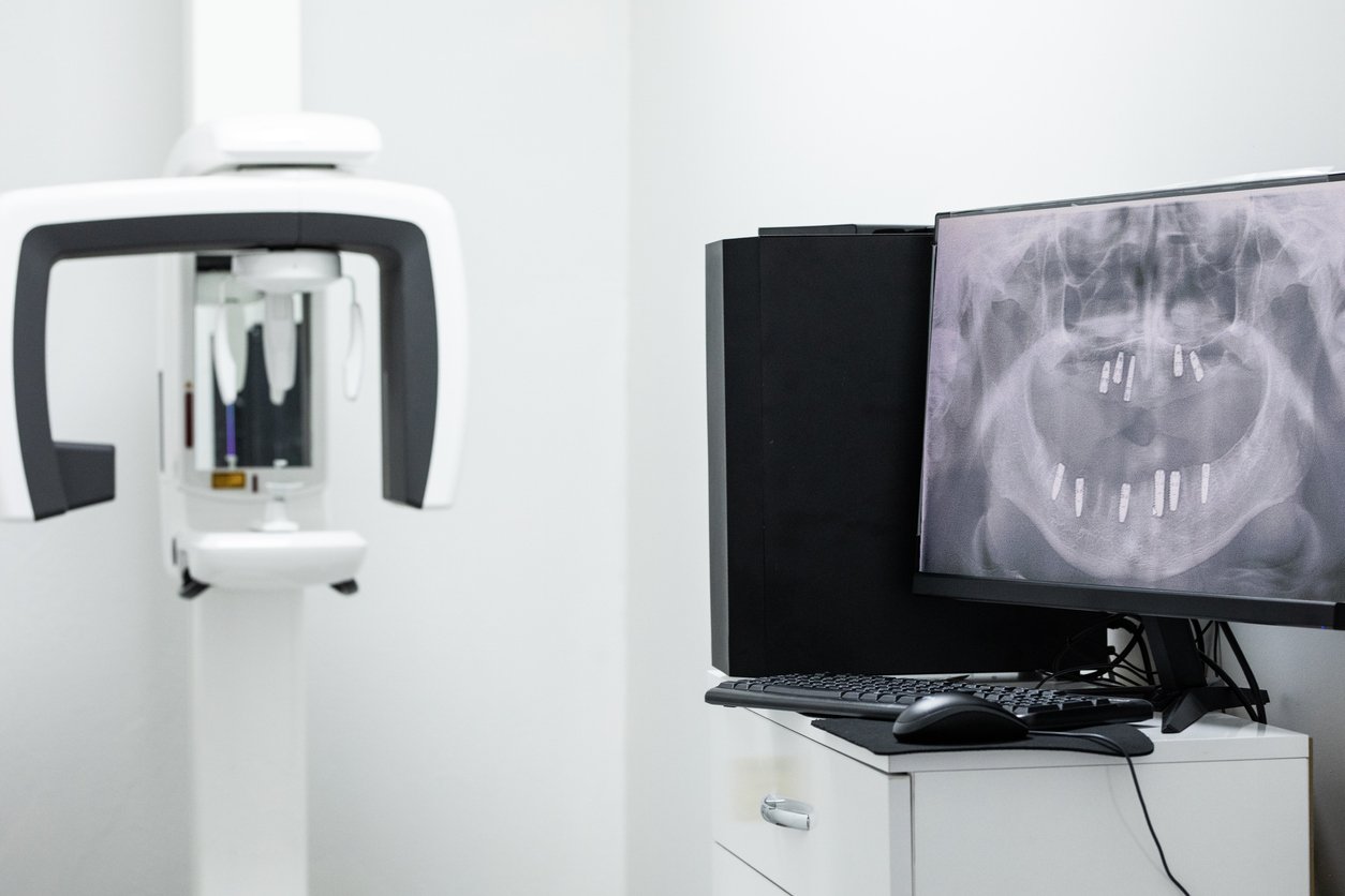 A dental imaging machine next to a computer displaying an X-ray of a patient's mouth in a dental treatment room.