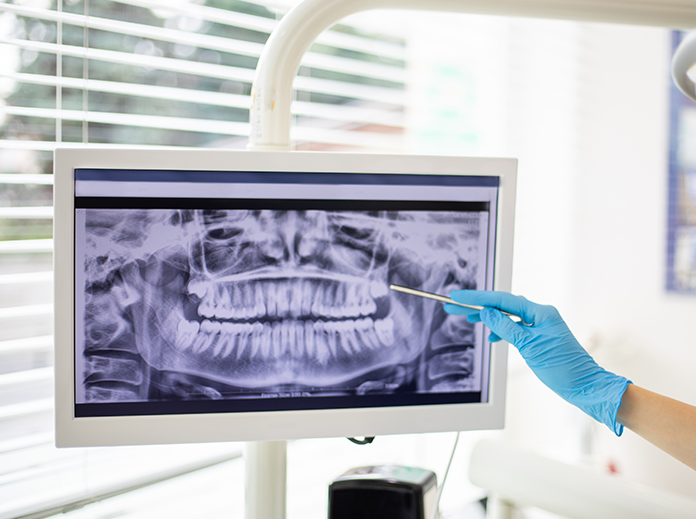 An operator pointing at an x-ray image of teeth displayed on a monitor in a dental office.