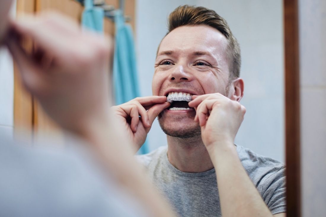 A man smiles while placing a clear dental aligner in his mouth in a bathroom mirror.