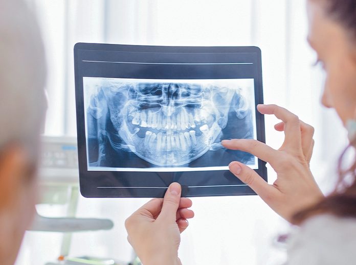 A dentist holding an X-ray image of a patient's teeth while discussing it with them in a dental office.